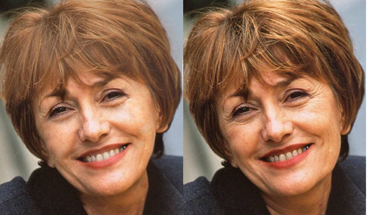 photo of the face before and after contour