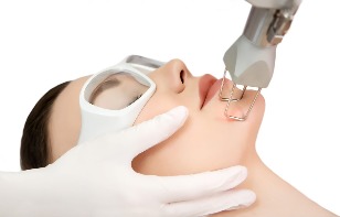 The laser rejuvenation of the skin of the face